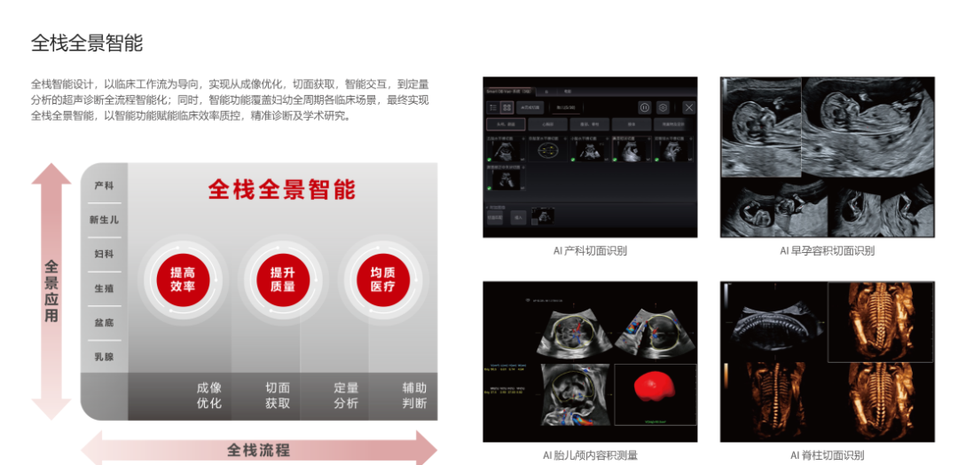 迈瑞，游向AI浪潮之巅！